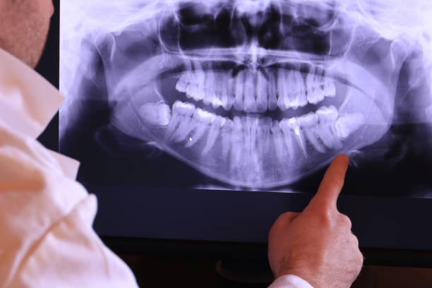Best Weekend Emergency Dentist in Richfield, WI