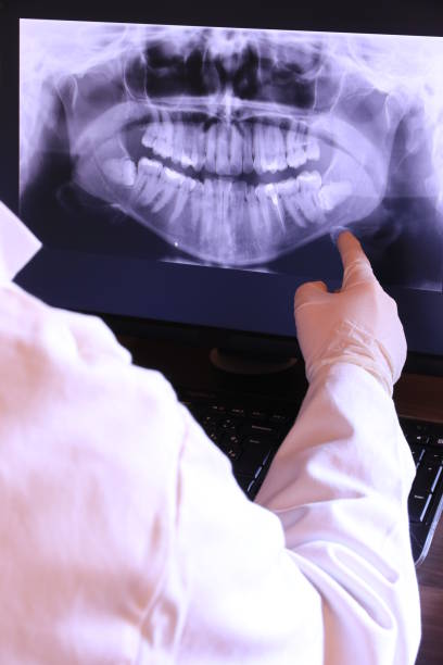 Best Emergency Treatment for Dental Infections or Abscesses in Richfield, WI