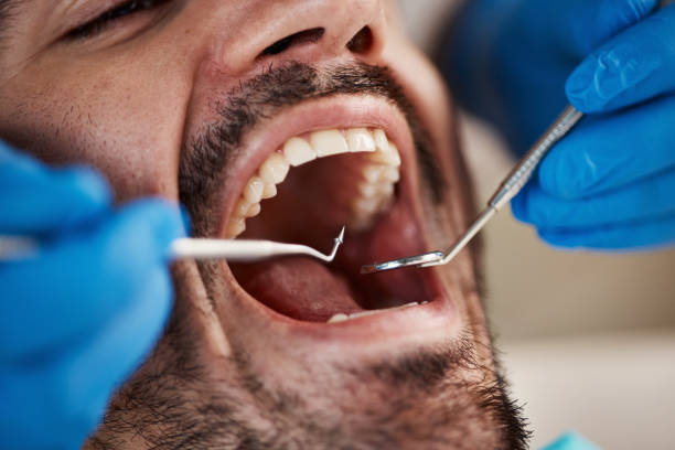 Best Emergency Treatment for Dental Infections or Abscesses in Richfield, WI